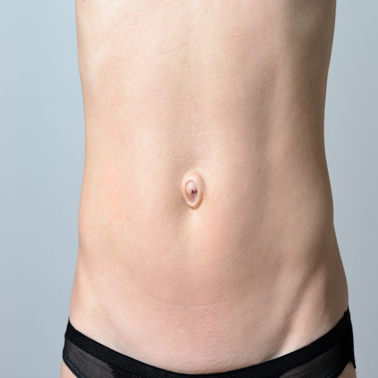 List 104+ Images why is my belly button brown Completed